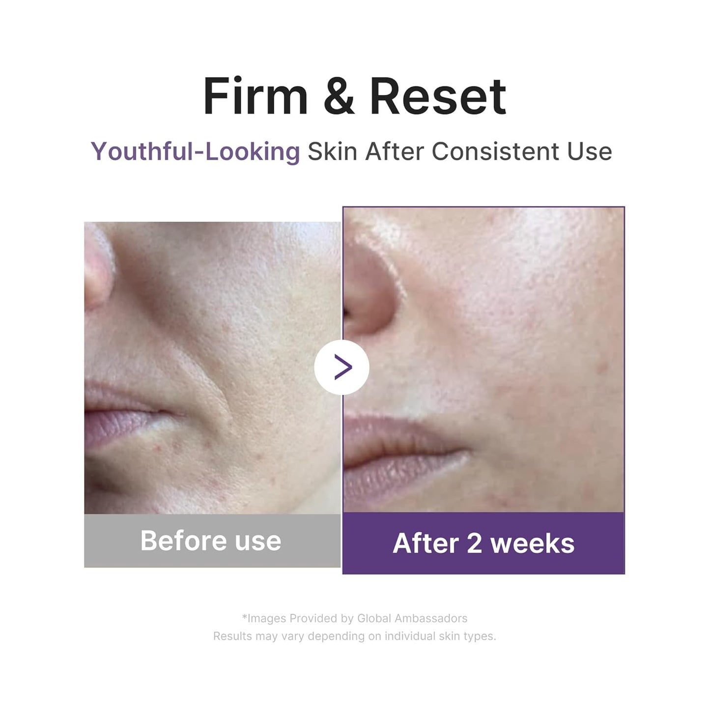 Medicube Retinol NMN Boosting Serum 30m